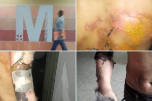3 heridos en accidente registrado en el Metro de Caracas